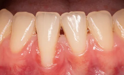 Programa de Especialización en Periodoncia